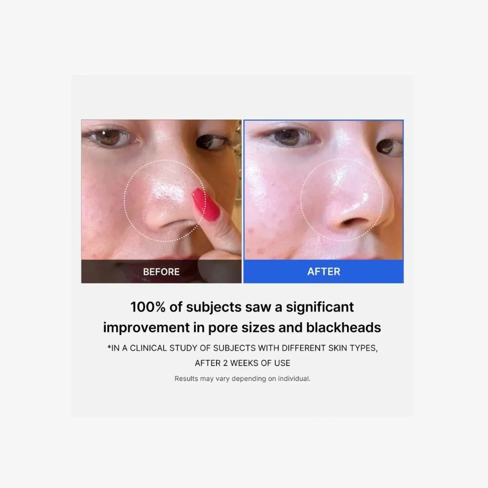 NIB Medicube Zero Pore Pad - 70 Count